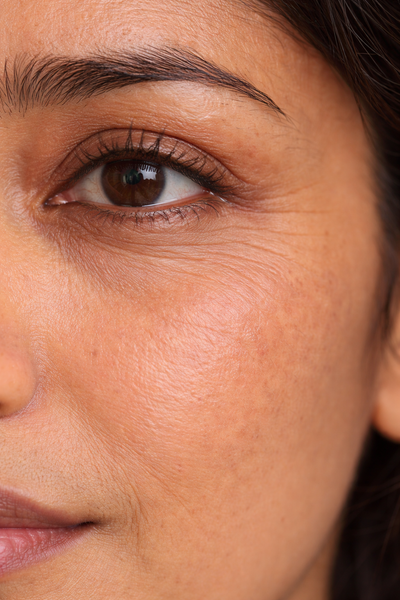Close-up of a woman's eye with visible wrinkles.